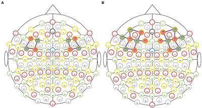 Impacts of complex electromagnetic radiation and low-frequency noise exposure conditions on the cognitive function of operators